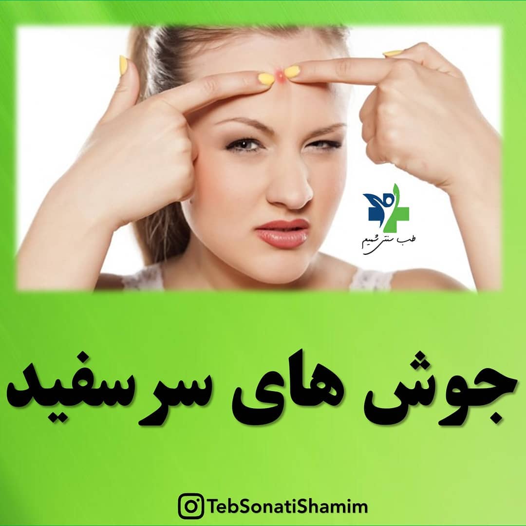 جوش‌ سرسفید