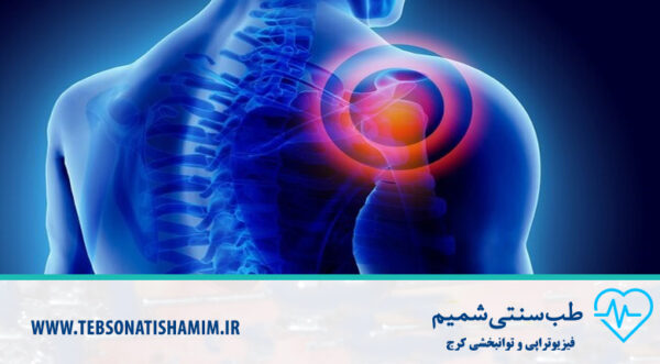 فیزیوتراپی و توانبخشی کرج درمان یخ زدگی شانه مرکز درمانی شمیم