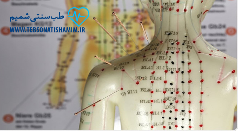 فیزیوتراپی و توانبخشی کرج