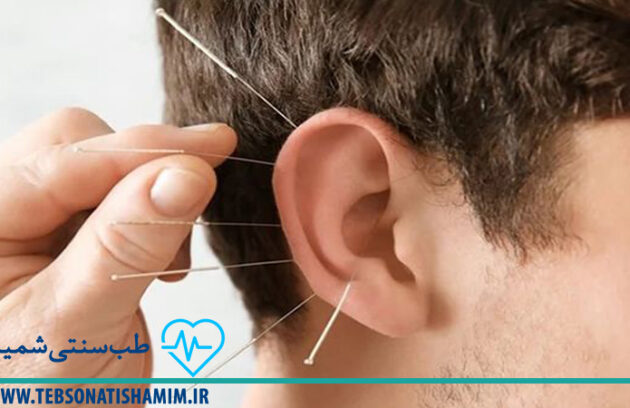 فیزیوتراپی و توانبخشی کرج | طب سوزنی در کرج