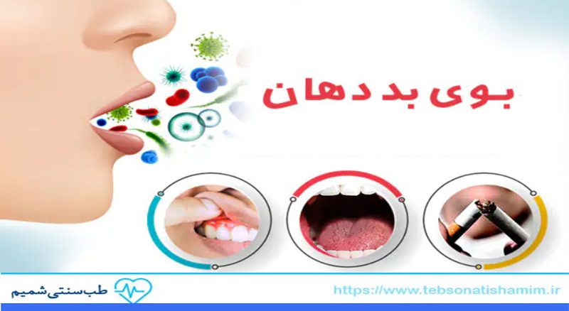 درمان بوی بد دهان در طب سنتی